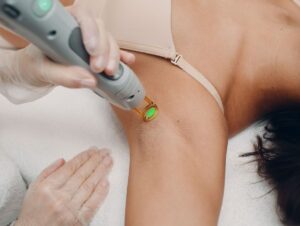 HAIR REMOVAL LASER 15